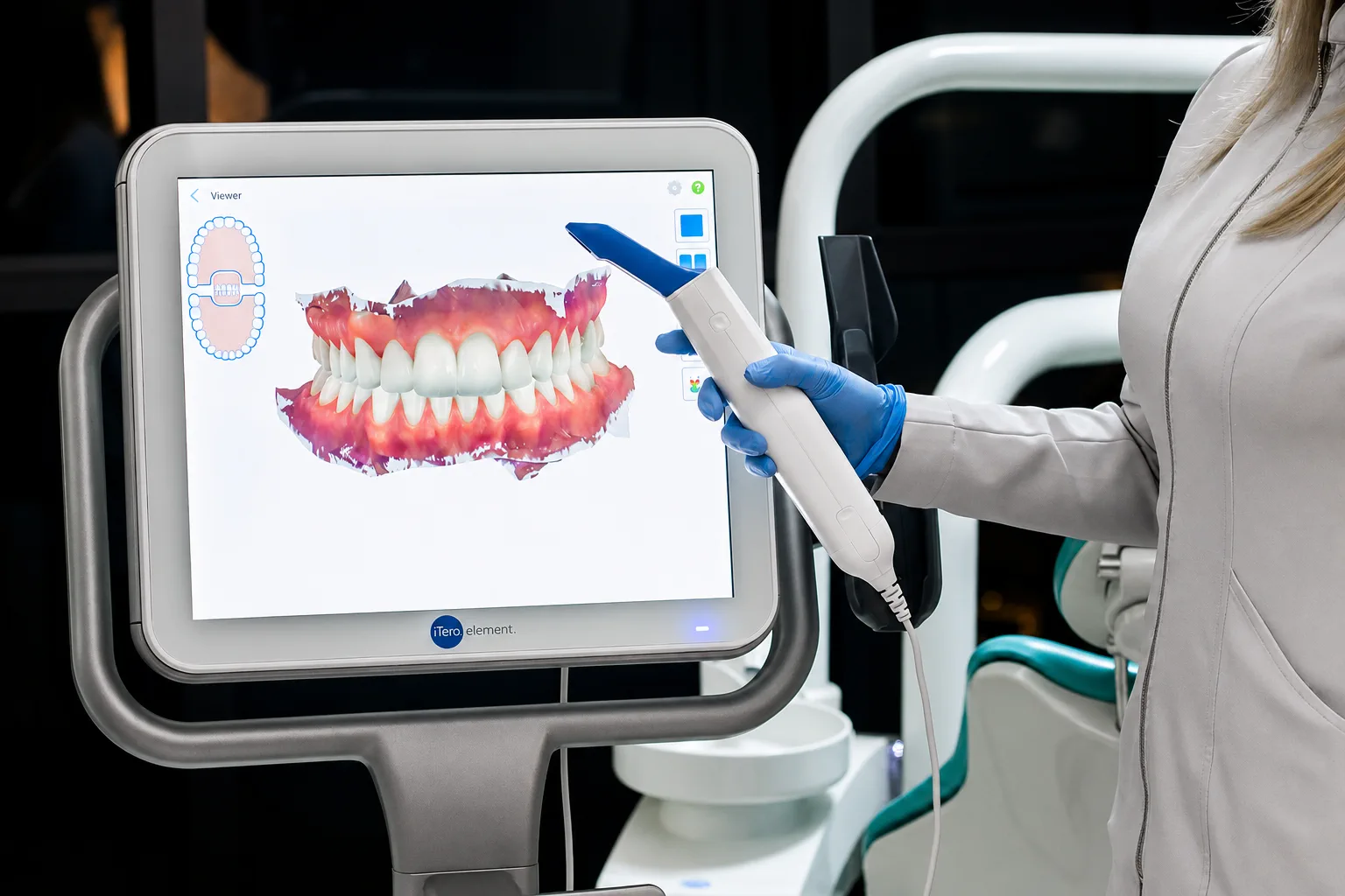Escaneamento digital iTero na Dental Vitta